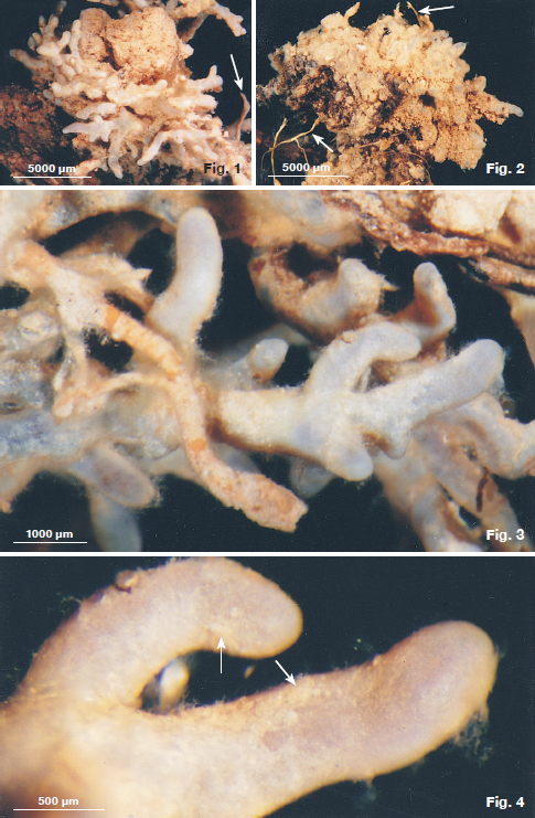 Planche en couleur de CDE21 des extrémités des racines ectomycorhiziens de Cantharellus formosus sur Tsuga heterophylla